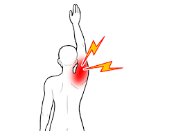 肩の痛みの症状